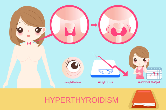 woman with hyperthyroidism